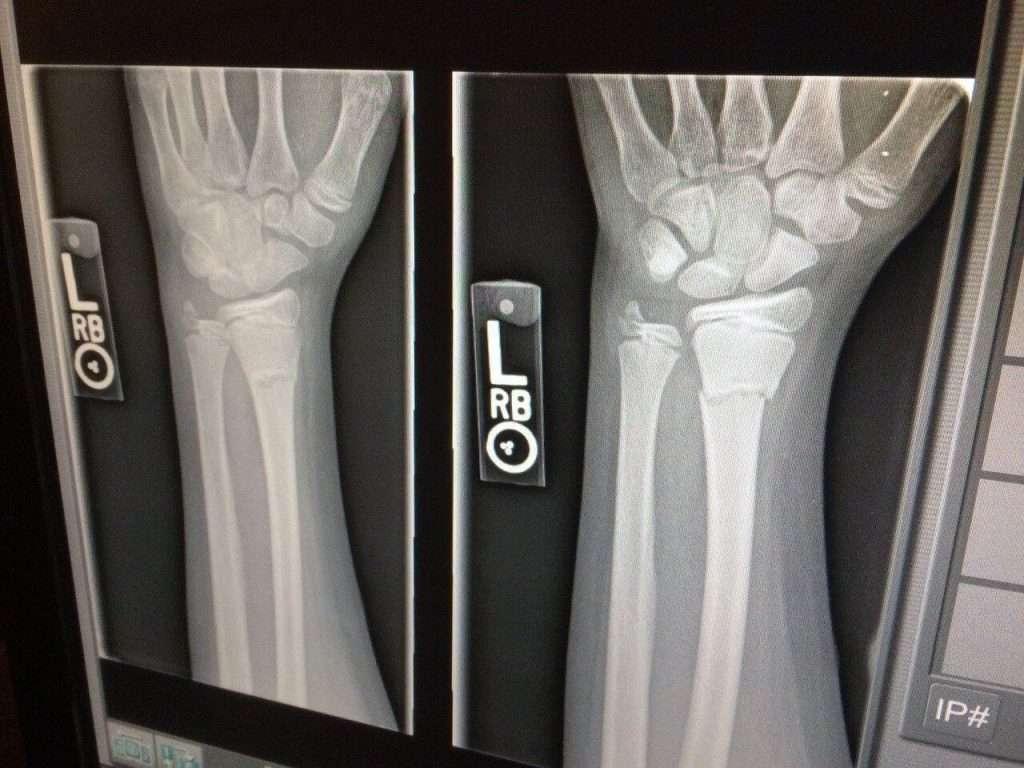 x ray